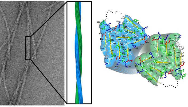 Empilement fibrillaire de la protéine alpha-synucléine observé au microscope électronique.