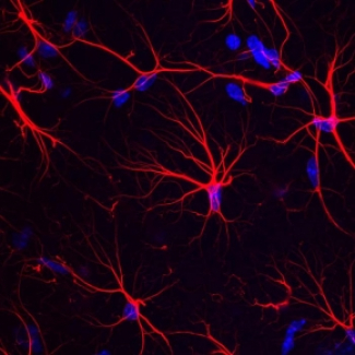 Alzheimer : un acide aminé pour aider à restaurer la mémoire ?