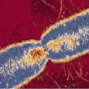 Nouvel éclairage sur la dissémination de la résistance aux carbapénèmes chez Escherichia coli