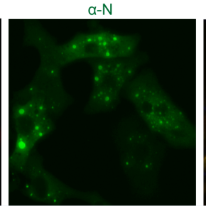 Immunofluorescence du Virus respiratoire syncitial