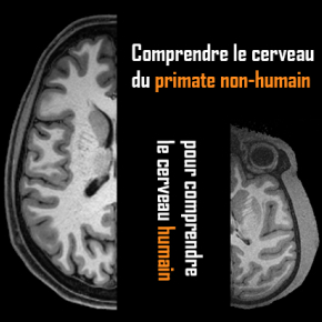 Coupe de cerveaux de primates