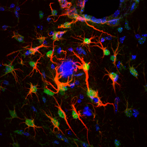 Astrocytes 