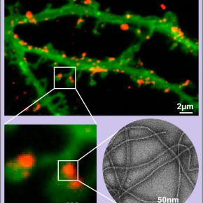 Protéines alzheimer