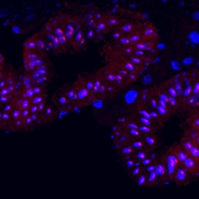 "Jouvence" augmente la longévité et protège les drosophiles contre les effets de l'âge